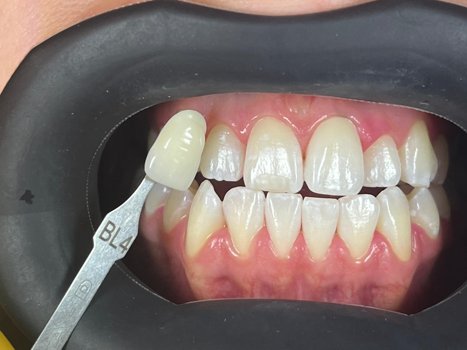 Experiencia de una clínica dental