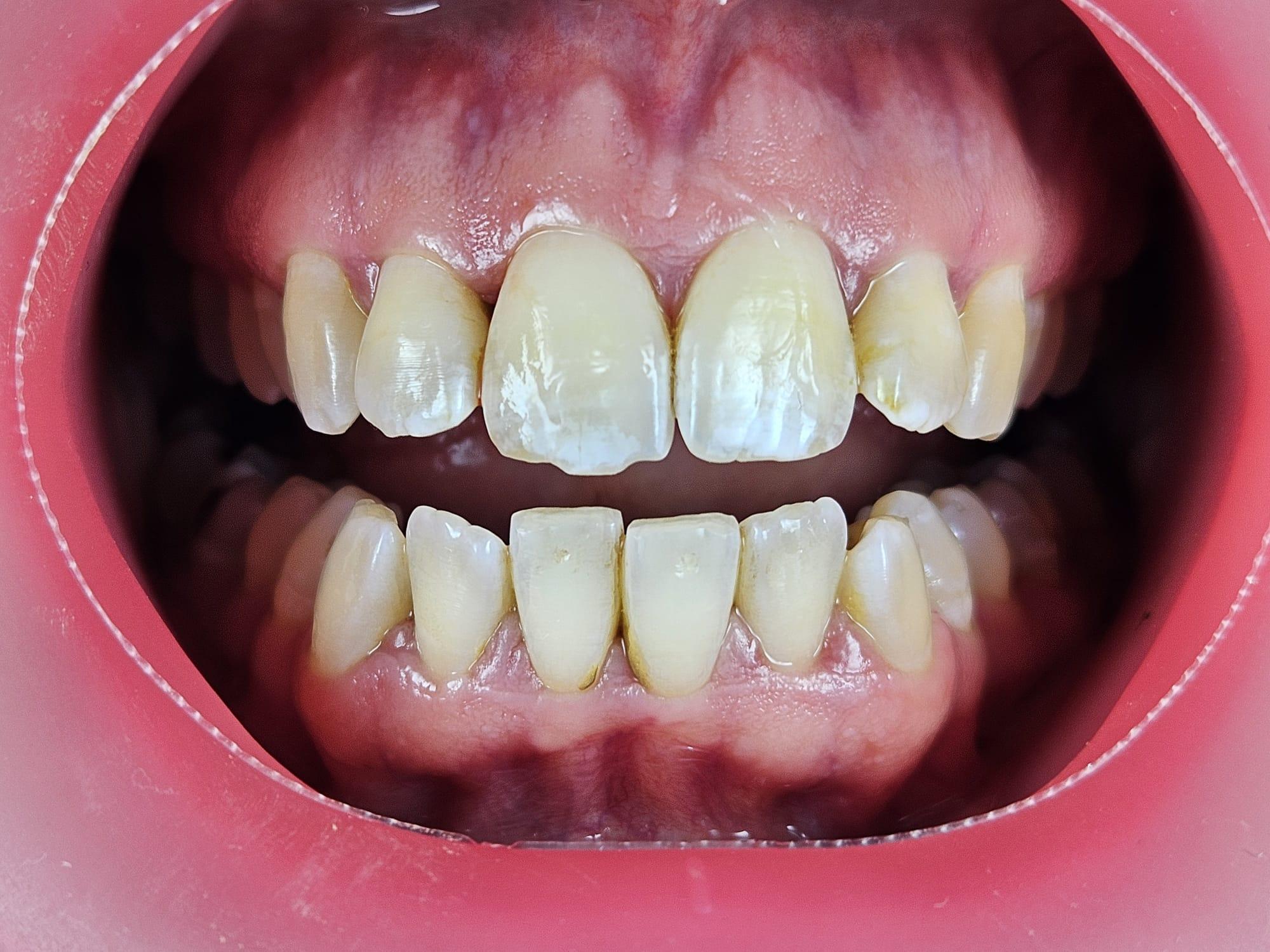 Variantes rosa y negra de VisionButler