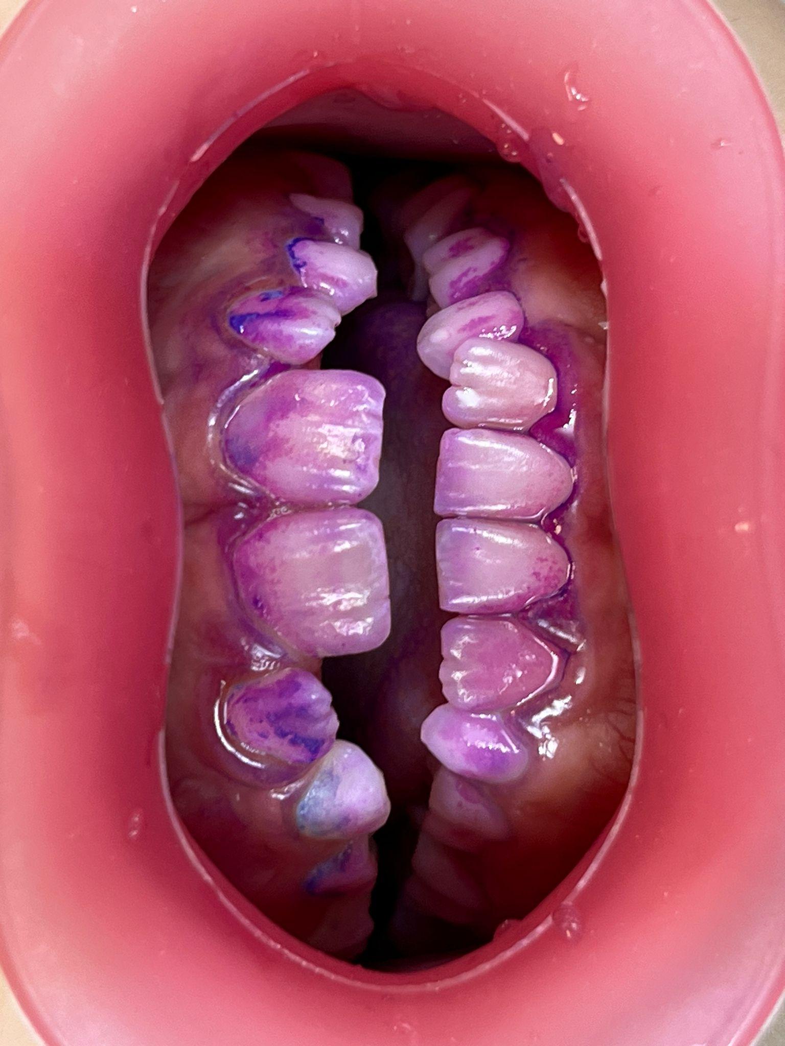 Fotografía dental intraoral: una guía práctica para la consulta moderna