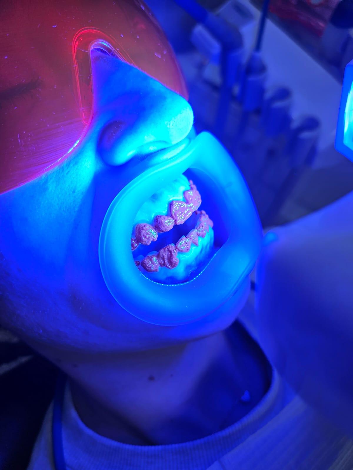 Mejor separador de labios y mejillas para el blanqueamiento dental (guía de compra)